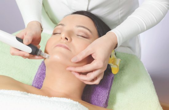 microneedling1 microneedling1