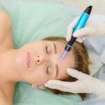 Microneedling doesn’t have to feel cosmetic-first. When approached as communication rather than correction, it becomes another way to support the body’s natural capacity for repair, balance, and resilience.