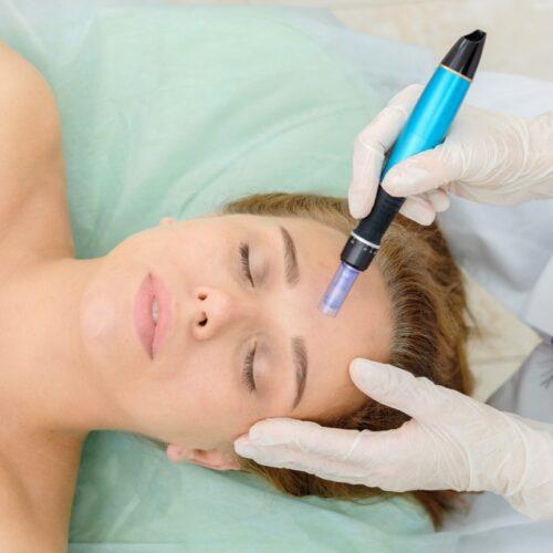 Microneedling doesn’t have to feel cosmetic-first. When approached as communication rather than correction, it becomes another way to support the body’s natural capacity for repair, balance, and resilience.