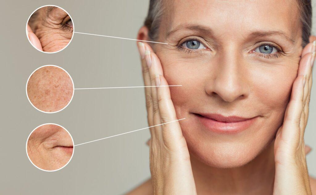 Patients notice an immediate “glow” to their skin. Visible changes to the skin develop over the course of several days and weeks.